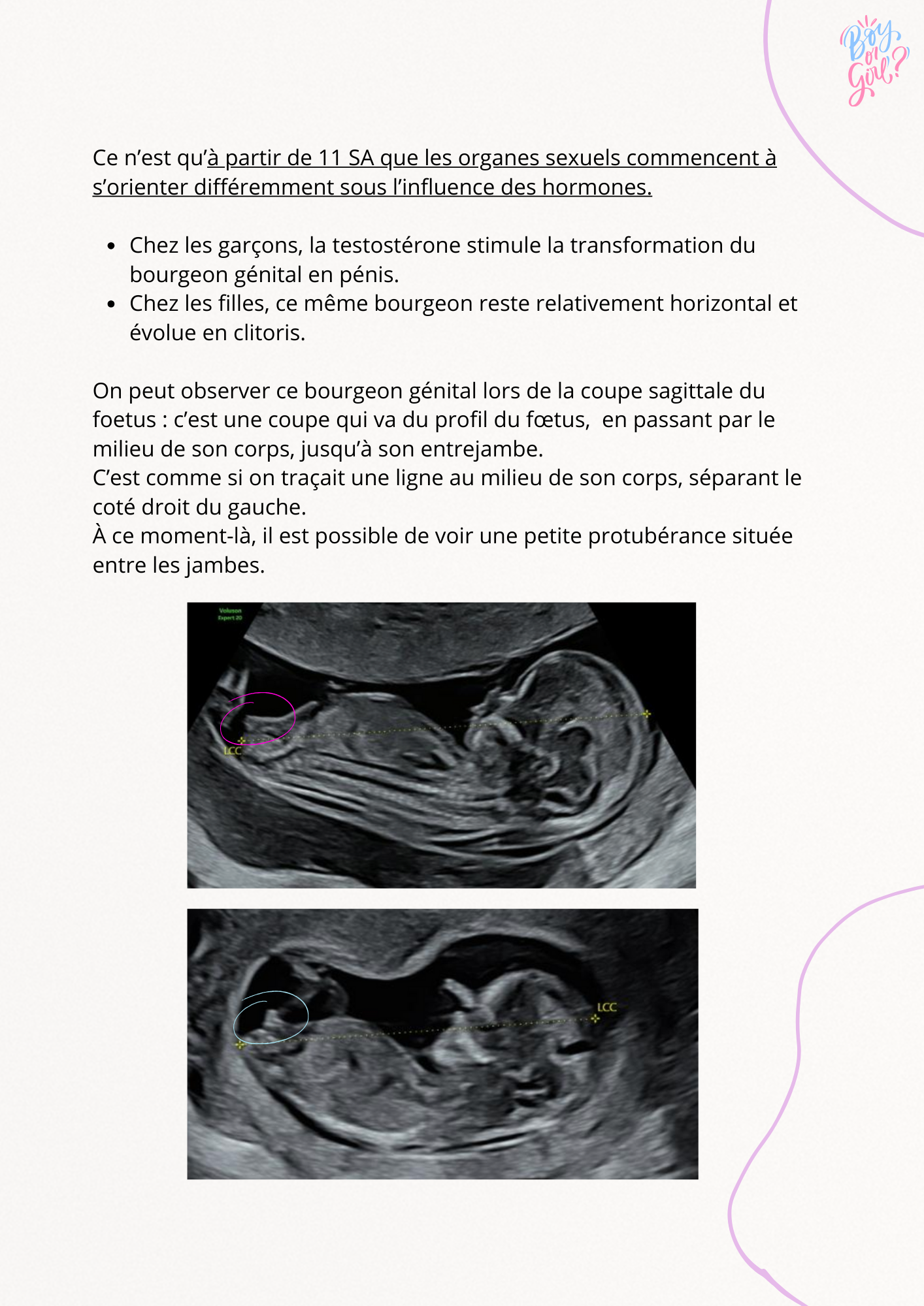 Comment reconnaître le sexe de bébé à l'échographie du 1er trimestre ?