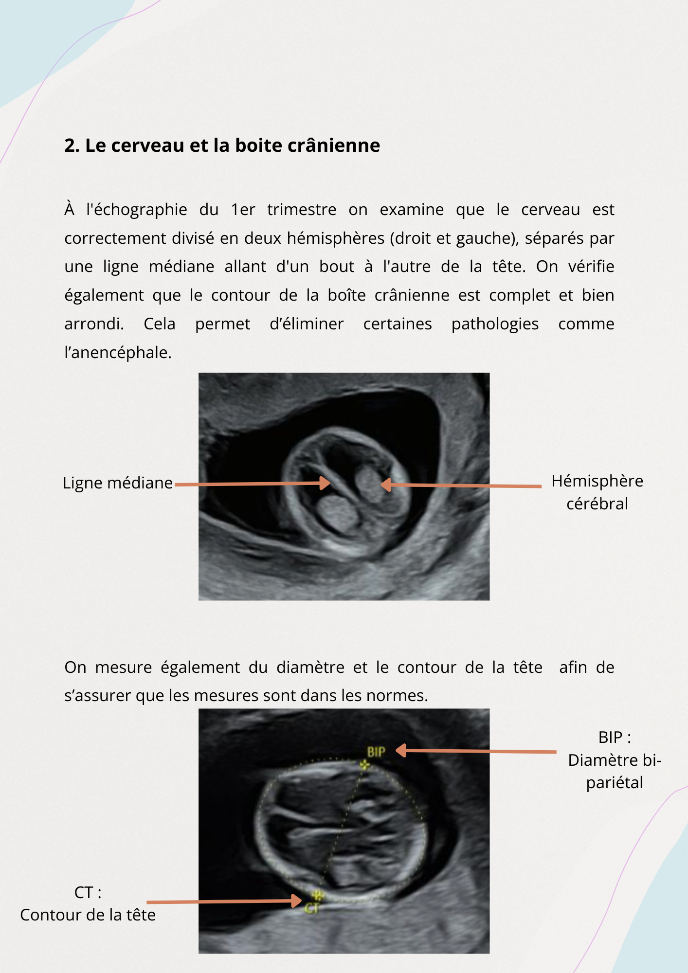 Tout Savoir sur l’Échographie du 1er Trimestre et le Dépistage de la Trisomie 21