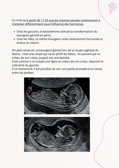 Comment reconnaître le sexe de bébé à l'échographie du 1er trimestre ?