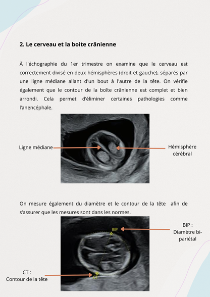 Tout Savoir sur l’Échographie du  1er Trimestre  et le  Dépistage de la  Trisomie 21